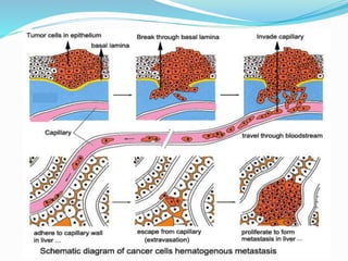 Cancer Tumor Diagram