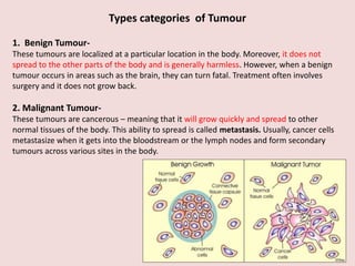 Types categories of Tumour
1. Benign Tumour-
These tumours are localized at a particular location in the body. Moreover, it does not
spread to the other parts of the body and is generally harmless. However, when a benign
tumour occurs in areas such as the brain, they can turn fatal. Treatment often involves
surgery and it does not grow back.
2. Malignant Tumour-
These tumours are cancerous – meaning that it will grow quickly and spread to other
normal tissues of the body. This ability to spread is called metastasis. Usually, cancer cells
metastasize when it gets into the bloodstream or the lymph nodes and form secondary
tumours across various sites in the body.
 