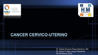 CANCER CERVICO-UTERINO
Dr. Rafael Eduardo Rojas Martínez MA
Dr. Oscar F. Nieto López Residente
R2 RX Marzo 2018.
 