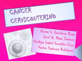 CANCER   CERVICOUTERINO Norma G. Homobono Rosas Itzel A. Rivas Jiménez Cinthya Isabel González Cruz Karina Espinoza Rodríguez 