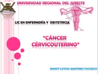 Universidad regional del sureste Lic en enfermería y  obstetricia “Cáncer  Cérvicouterino” Nancy leticiamartinez pacheco 