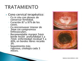    Cono cervical terapéutico:
    ◦ Ca in situ con deseos de
      conservar fertilidad.
    ◦ Curación 87 a 97% de los
      casos.
    ◦ Ca microinvasor (menor de
      3mm sin compromiso
      linfovascular).
    ◦ Recomendable margen 5mm
      borde lesión profundidad 5 a
      7mm: enfermedad residual 5 a
      40%, en bordes libres recaída
      3%.
    ◦ Seguimiento más
      riguroso, citología cada 3
      meses.

                                      MANUAL INCAN MEXICO, 2000
 