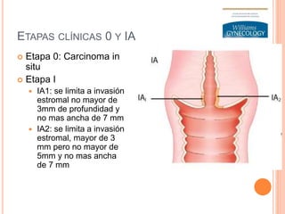 ETAPAS CLÍNICAS 0 Y IA
 Etapa 0: Carcinoma in
situ
 Etapa I
 IA1: se limita a invasión
estromal no mayor de
3mm de profundidad y
no mas ancha de 7 mm
 IA2: se limita a invasión
estromal, mayor de 3
mm pero no mayor de
5mm y no mas ancha
de 7 mm
 