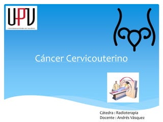 Cáncer Cervicouterino
Cátedra : Radioterapia
Docente : Andrés Vásquez
 