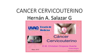 CANCER CERVICOUTERINO
Hernán A. Salazar G
 