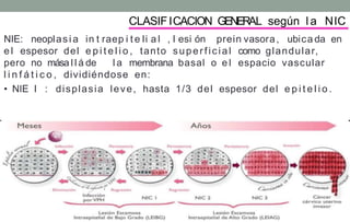 CLASIFICACION GENERAL según l a NIC
NIE: neoplasi a in t raep i t e li a l , l esi ón prein vasora, ubica da en
e l espesor del e p i t e l i o , tanto superficial como glandular,
pero no mása l l á de l a membrana basal o e l espacio vascular
l i n f á t i c o , dividiéndose en:
• NIE I : displasia leve, hasta 1/3 del espesor del e p i t e l i o .
•
 