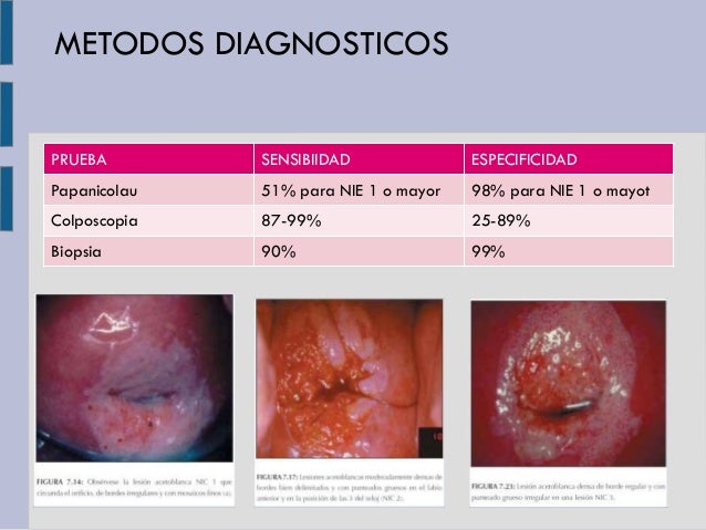 Exame de colposcopia com biopsia