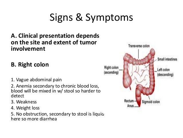 Cancer Colon