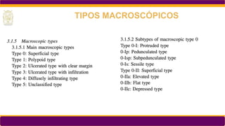 TIPOS MACROSCÓPICOS
 