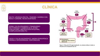 RECTO: URGENCIA RECTAL, TENESMO, DIARREA CON
MOCO Y SANGRE, HECES ACINTADAS
SIGMA, COLON IZQUIERDO Y TRANSVERSO:
RECTORRAGIA Y CAMBIOS EN EL RITMO
EVACUATORIO, OBSTRUCCIÓN INTESTINAL
(COMPLICACION MÁS FC)
CIEGO Y COLON ASCENDENTE: ANEMIA FERROPÉNICA
CRÓNICA, ENTERORRAGIA, PERFORACIÓN
CLÍNICA
 