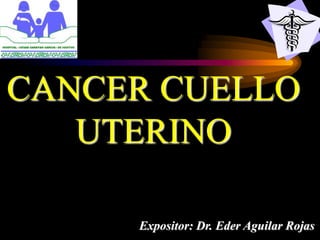 CANCER CUELLO
UTERINO
Expositor: Dr. Eder Aguilar Rojas
 