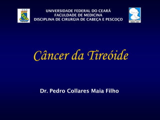 Câncer da Tireóide
Dr. Pedro Collares Maia Filho
UNIVERSIDADE FEDERAL DO CEARÁ
FACULDADE DE MEDICINA
DISCIPLINA DE CIRURGIA DE CABEÇA E PESCOÇO
 