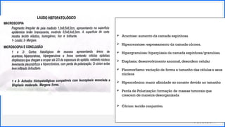 Contoso
P a c o t e s
31
 Acantose: aumento da camada espinhosa
 Hiperceratose: espessamento da camada córnea.
 Hipergranulosa: hiperplasia da camada espinhosa/granulosa
 Displasia: desenvolvimento anormal, desordem celular
 Pleomorfismo: variação de forma e tamanho das células e seus
núcleos
 Hipercrômico: maoir afinidade ao corante devido ao tamanho
 Perda de Polarização: formação de massas tumorais que
crescem de maneira desorganizada
 Córion: tecido conjuntivo.
 