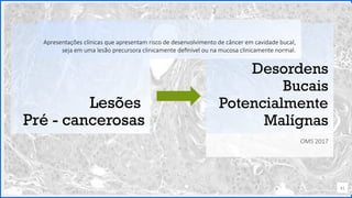 Contoso
P a c o t e s
Lesões
Pré - cancerosas
41
Desordens
Bucais
Potencialmente
Malígnas
OMS 2017
Apresentações clínicas que apresentam risco de desenvolvimento de câncer em cavidade bucal,
seja em uma lesão precursora clinicamente definível ou na mucosa clinicamente normal.
 
