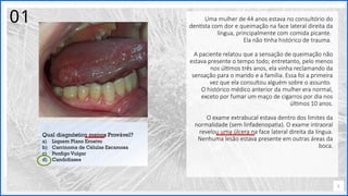 Contoso
P a c o t e s
Opção 2 de Divisor
de Seção
Lorem ipsum dolor sit ame
adipiscing elit
Uma mulher de 44 anos estava no consultório do
dentista com dor e queimação na face lateral direita da
língua, principalmente com comida picante.
Ela não tinha histórico de trauma.
A paciente relatou que a sensação de queimação não
estava presente o tempo todo; entretanto, pelo menos
nos últimos três anos, ela vinha reclamando da
sensação para o marido e a família. Essa foi a primeira
vez que ela consultou alguém sobre o assunto.
O histórico médico anterior da mulher era normal,
exceto por fumar um maço de cigarros por dia nos
últimos 10 anos.
O exame extrabucal estava dentro dos limites da
normalidade (sem linfadenopatia). O exame intraoral
revelou uma úlcera na face lateral direita da língua.
Nenhuma lesão estava presente em outras áreas da
boca.
5
Qual diagnóstico menos Provável?
a) Liquem Plano Erosívo
b) Carcinoma de Células Escamosa
c) Penfigo Vulgar
d) Candidíases
01
 