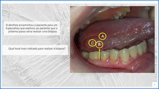 Contoso
P a c o t e s
Opção 2 de Divisor
de Seção
Lorem ipsum dolor sit ame
adipiscing elit
O dentista encaminhou o paciente para um
Especialista que explicou ao paciente que o
próximo passo seria realizar uma biópsia.
6
Qual local mais indicado para realizar a biópsia?
 