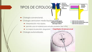 TIPOS DE CITOLOGIA
 Citología convencional.
 Citología cervical en medio líquido.
 interpretación más rápida.
 permite usar el material para estudio posterior (test VPH)
 no mejora la precisión diagnóstica.
 Citología automatizada.
 