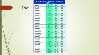 TNM
 