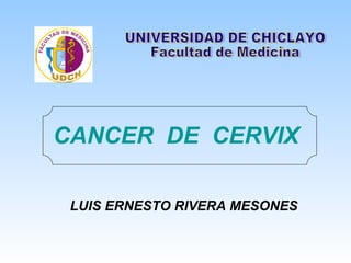 CANCER  DE  CERVIX LUIS ERNESTO RIVERA MESONES UNIVERSIDAD DE CHICLAYO Facultad de Medicina  