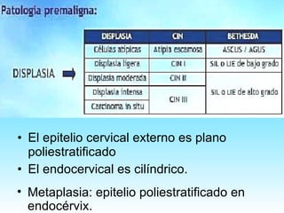El epitelio cervical externo es plano poliestratificado  El endocervical es cilíndrico. Metaplasia: epitelio poliestratificado en endocérvix. 