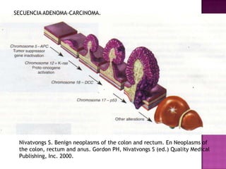 SECUENCIA ADENOMA-CARCINOMA.Nivatvongs S. Benign neoplasms of the colon and rectum. En Neoplasms of the colon, rectum and anus. Gordon PH, Nivatvongs S (ed.) Quality Medical Publishing, Inc. 2000.