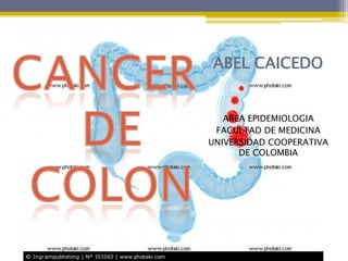 ABEL CAICEDO


   AREA EPIDEMIOLOGIA
 FACULTAD DE MEDICINA
UNIVERSIDAD COOPERATIVA
      DE COLOMBIA
 