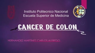 CANCER DE COLON
HERNANDEZ MARTÍNEZ CARLOS ALFREDO
Instituto Politecnico Nacional
Escuela Superior de Medicina
 