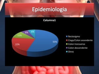 Columna1



       6%   6%
 11%                         Rectosigmo
                             Ciego/Colon ascendente
                       55%
22%                          Colon transverso
                             Colon descendente
                             Otros
 
