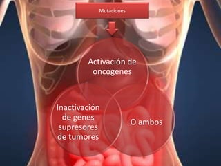 Mutaciones




        Activación de
         oncogenes



Inactivación
  de genes
                        O ambos
 supresores
de tumores
 