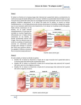 Cáncer de Colon: “El estigma oculto”
2015
11
Etapa I
El cáncer se formó en la mucosa (capa más interna) de la pared del colon y se diseminó a la
submucosa (capa de tejido debajo de la mucosa). También se puede haber diseminado a la capa
muscular de la pared del colon pero no se propagó fuera de la pared del colon en sí (ni hacia los
ganglios linfáticos adyacentes). Si el cáncer fue parte de un pólipo, el mismo se extrae
completamente, y si no había presencia de células cancerosas en los bordes (márgenes), puede
que no sea necesario administrar otro tratamiento. Si el cáncer en el pólipo era de alto grado,
había células cancerosas en los
bordes, no se pudo extirpar
completamente o si tuvo que ser
extraído en muchos fragmentos,
dificultando ver si había células
cancerosas en los bordes, se
puede recomendar realizar más
cirugía. Para los cánceres que no
estánenun pólipo,el tratamiento
consiste en colectomía parcial
(cirugía para extirpar la sección
del colon que contiene cáncer y
los ganglios linfáticos cercanos).
No se necesita terapia adicional.
Fuente: www.cancer.gov
Etapa II
En este estadio, el cáncer se divide en partes:
 Estadio IIA: el cáncer se diseminó a través de la capa muscular de la pared del colon a
la serosa (capa más externa) de la pared del colon.
 Estadio IIB: el cáncer se diseminó a través de la serosa (capa más externa) de la pared
del colon, pero no a los órganos cercanos.
 Estadio IIC: el cáncer se diseminó a través de la serosa (capa más externa) de la pared
del colon a órganos cercanos.
Fuente: www.cancer.gov
 