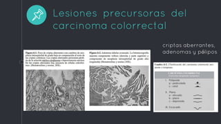 Lesiones precursoras del
carcinoma colorrectal
criptas aberrantes,
adenomas y pólipos
 