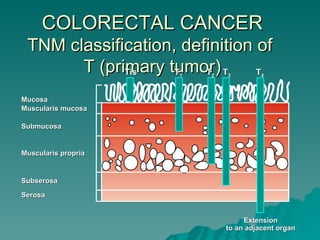 COLORECTAL CANCER
 TNM classification, definition of
       T (primary tumor) T
             Tis    T1  T2   3  T      4




Mucosa
Muscularis mucosa

Submucosa


Muscularis propria


Subserosa
Serosa


                                  Extension
                             to an adjacent organ
 