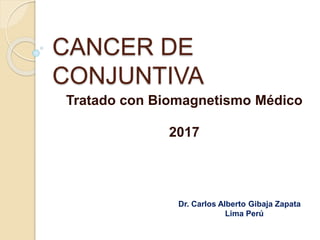 CANCER DE
CONJUNTIVA
Tratado con Biomagnetismo Médico
2017
Dr. Carlos Alberto Gibaja Zapata
Lima Perú
 