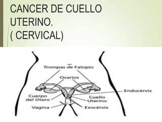 CANCER DE CUELLO
UTERINO.
( CERVICAL)
 