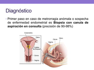 Diagnóstico
• Primer paso en caso de metrorragia anómala o sospecha
de enfermedad endometrial es Biopsia con canula de
aspiración en consulta (precisión de 90-98%)
 