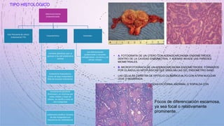 TIPO HISTOLÓGICO
Adenocarcinoma
endometrioide:
más frecuente de cáncer
endometrial 75%
Característica:
contiene glándulas que se
parecen a las del endometrio
normal
Endometrio hiperplásico:
tumor de baja malignidad y
falta de invasión miometrial.
componente glandular
disminuye y se sustituye por
nidos sólidos y hojas de
células, se clasifica como de
alta malignidad
endometrio atrófico: lesiones
de alta malignidad con
frecuencia son metastásicas
Variantes:
con diferenciación
epidermoide y variantes
velloglandular, secretora y de
células ciliadas
• A. FOTOGRAFÍA DE UN ÚTERO CON ADENOCARCINOMA ENDOMETRIOIDE.
DENTRO DE LA CAVIDAD ENDOMETRIAL Y ADEMÁS INVADE LAS PAREDES
MIOMETRIALES.
• B. MICROFOTOGRAFÍA DE UN ADENOCARCINOMA ENDOMETRIOIDE. FORMADOS
POR GLÁNDULAS NEOPLÁSICAS QUE SIMULAN LAS DEL ENDOMETRIO SANO.
• LAS CÉLULAS CONSTAN DE EPITELIO CILÍNDRICO ALTO CON ATIPIA NUCLEAR
LEVE O MODERADA.
ADAS EN FORMA ANORMAL O “ESPALDA CON
• FORMAN GLÁNDULAS APIL
ESPALDA”.
Focos de diferenciación escamosa,
ya sea focal o relativamente
prominente.
 