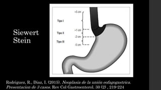 T
Winikere, M., Mantziri, S., Figueiredo, S. G. (2018). Accuracy of preoperative staging for a
priori resectable esophagea...