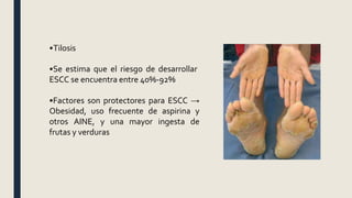•Tilosis
•Se estima que el riesgo de desarrollar
ESCC se encuentra entre 40%-92%
•Factores son protectores para ESCC →
Obesidad, uso frecuente de aspirina y
otros AINE, y una mayor ingesta de
frutas y verduras
 