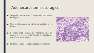 Adenocarcinoma esofágico
■ Segunda forma más común de carcinoma
esofágico
■ Tipo predominante de cáncer de esófago en el
Oeste
■ 8 veces más común en hombres que en
mujeres, y 5 veces más común en caucásicos
que en afroamericanos
■ Factor de riesgo → Alto nivel socioeconómico
 