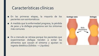 Características clínicas
■ En las primeras etapas, la mayoría de los
pacientes son asintomáticos
■ A medida que la enfermedad progresa, la pérdida
de peso y la disfagia progresiva son los síntomas
más comunes
■ Dx a menudo se retrasa porque los pacientes que
experimentan disfagia tienden a evitar los
alimentos que causan el síntoma y ajustan su
ingesta dietética (Sólidos → Líquidos)
 