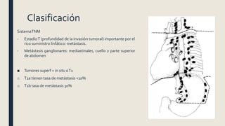 Clasificación
SistemaTNM
- EstadíoT (profundidad de la invasión tumoral) importante por el
rico suministro linfático: metástasis.
- Metástasis ganglionares: mediastinales, cuello y parte superior
de abdomen
■ Tumores superf = in situ oT1
o T1a tienen tasa de metástasis <10%
o T1b tasa de metástasis 30%
 