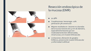 Resección endoscópica de
la mucosa (EMR)
■ 91-98%
■ Complicaciones: hemorragia -10%
perforación 3% constricción
■ Mejores resultados en : lesiones no ulceradas
de la mucosa menores de 15 mm de diámetro,
especialmente lesiones que son
moderadamente bien diferenciadas,
intramucosa y sin invasión linfovascular.
■ Limitaciones: afectación de ganglios
linfáticos, presencia de invasión linfovascular
y enfermedad multifocal
 
