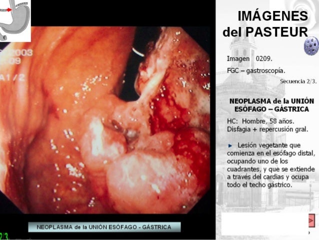 Que puedo tomar para adelgazar la panza rapido que puedo tomar para adelgazar la panza rapido