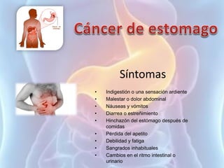Síntomas
• Indigestión o una sensación ardiente
• Malestar o dolor abdominal
• Náuseas y vómitos
• Diarrea o estreñimiento
• Hinchazón del estómago después de
comidas
• Pérdida del apetito
• Debilidad y fatiga
• Sangrados inhabituales
• Cambios en el ritmo intestinal o
urinario
 