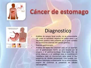 Diagnostico
• Análisis de sangre fecal oculta, no es enteramente
útil, pues un resultado negativo no indica nada y un
resultado positivo está presente en un gran número
de condiciones además del cáncer gástrico.
• Examen gastroscopio.
• Análisis del tejido fino anormal visto en un examen
con el gastroscopio hecho en una biopsia por el
cirujano o el gastroenterólogo. Este tejido fino se
envía después a un patólogo para la examinación
histológica bajo un microscopio para saber si hay
presencia de células cancerosas. Una biopsia, con
análisis histológico subsecuente, es la única manera
segura de confirmar la presencia de células
cancerígenas.
 