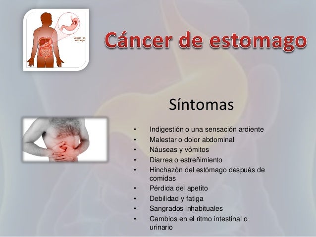 Cancer de estomago Cancer de estomago
