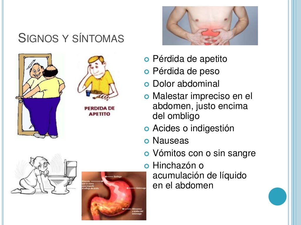 Sintomas de cancer intestino delgado