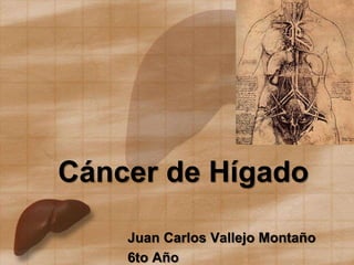 Cáncer de Hígado
Juan Carlos Vallejo Montaño
6to Año
 