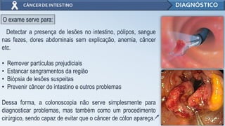 10
DIAGNÓSTICO
Detectar a presença de lesões no intestino, pólipos, sangue
nas fezes, dores abdominais sem explicação, anemia, câncer
etc.
• Remover partículas prejudiciais
• Estancar sangramentos da região
• Biópsia de lesões suspeitas
• Prevenir câncer do intestino e outros problemas
Dessa forma, a colonoscopia não serve simplesmente para
diagnosticar problemas, mas também como um procedimento
cirúrgico, sendo capaz de evitar que o câncer de cólon apareça.
O exame serve para:
 