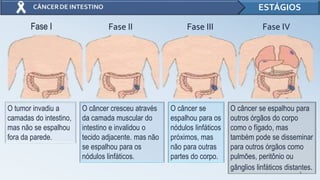 4
ESTÁGIOS
O tumor invadiu a
camadas do intestino,
mas não se espalhou
fora da parede.
O câncer cresceu através
da camada muscular do
intestino e invalidou o
tecido adjacente. mas não
se espalhou para os
nódulos linfáticos.
O câncer se
espalhou para os
nódulos linfáticos
próximos, mas
não para outras
partes do corpo.
O câncer se espalhou para
outros órgãos do corpo
como o fígado, mas
também pode se disseminar
para outros órgãos como
pulmões, peritônio ou
gânglios linfáticos distantes.
Fase I Fase II Fase III Fase IV
 
